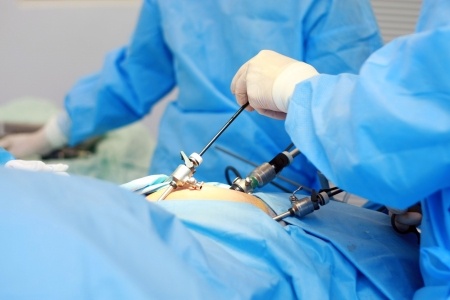 Surgery- maa fartility